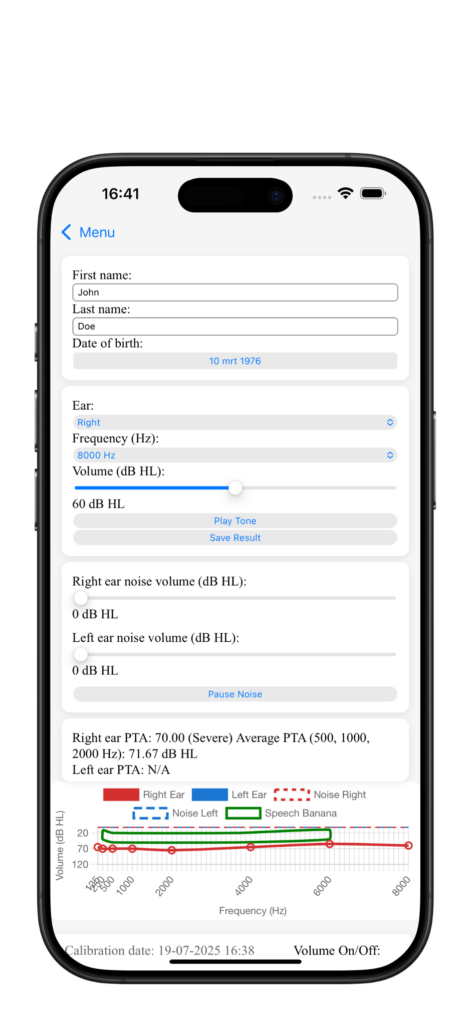 HearingScan Pro iOS