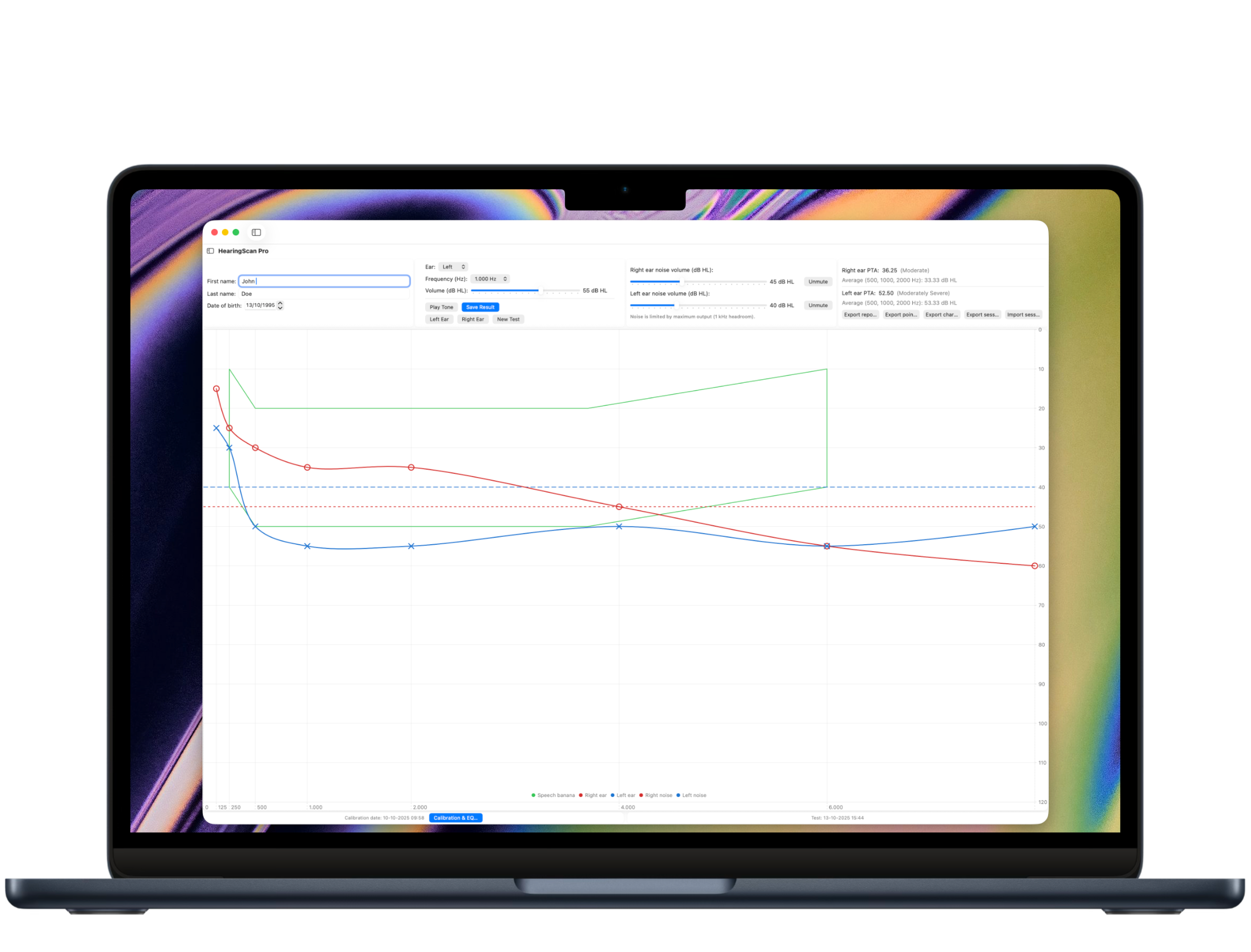 HearingScan Pro Mac