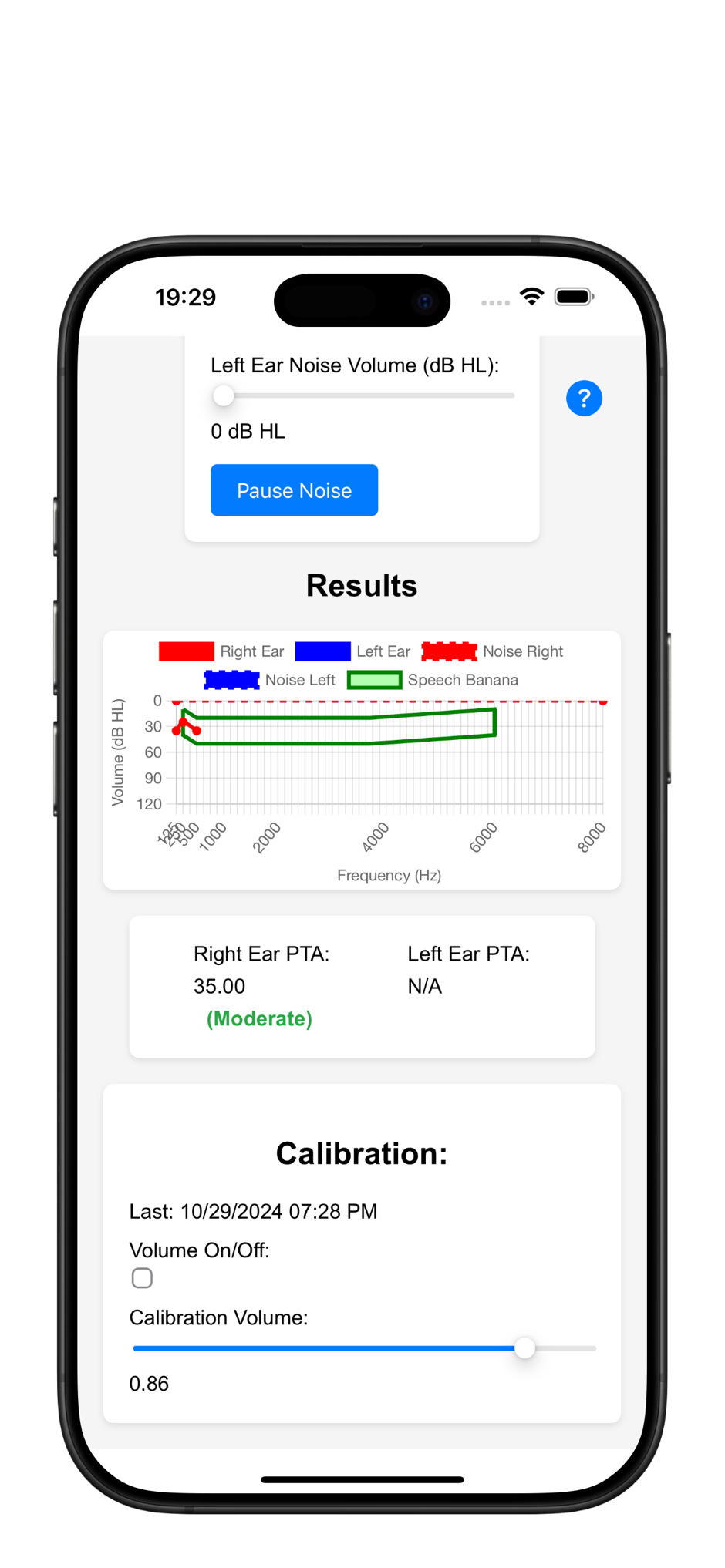 HearingScan Pro iOS
