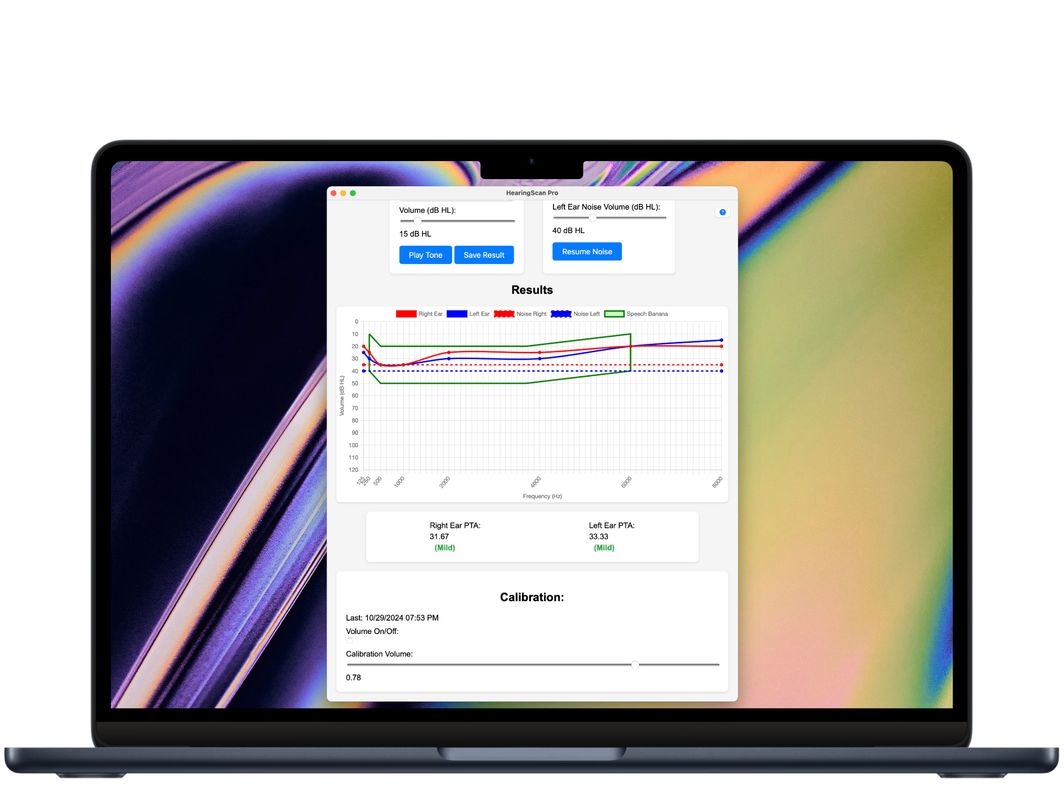 HearingScan Pro Mac